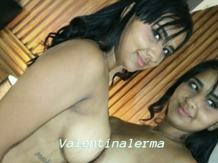 Valentinalerma